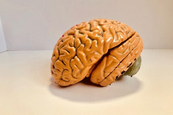Photo Brain circuitry