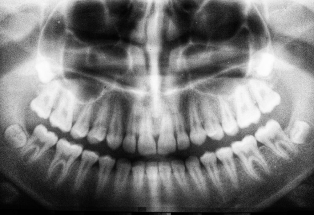 Photo Brain scan