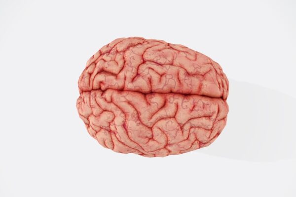 Photo Brain scans