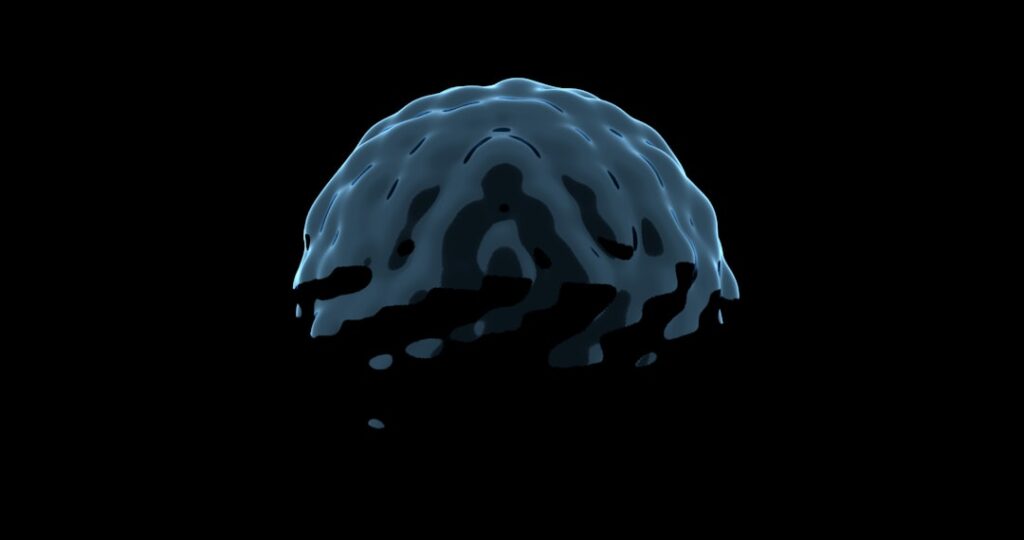 Photo Brain scan