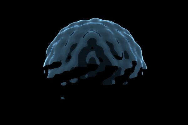 Photo Brain scan