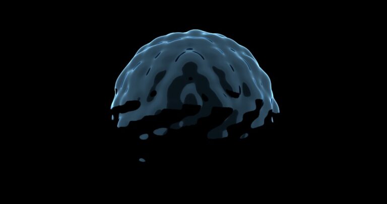 Photo Brain scan