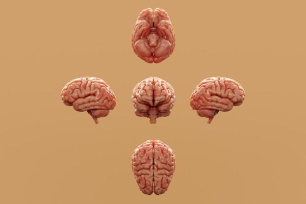 Photo Brain diagram