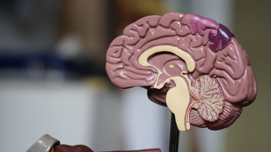 Brain scan