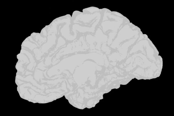 Photo Whole-Brain Child