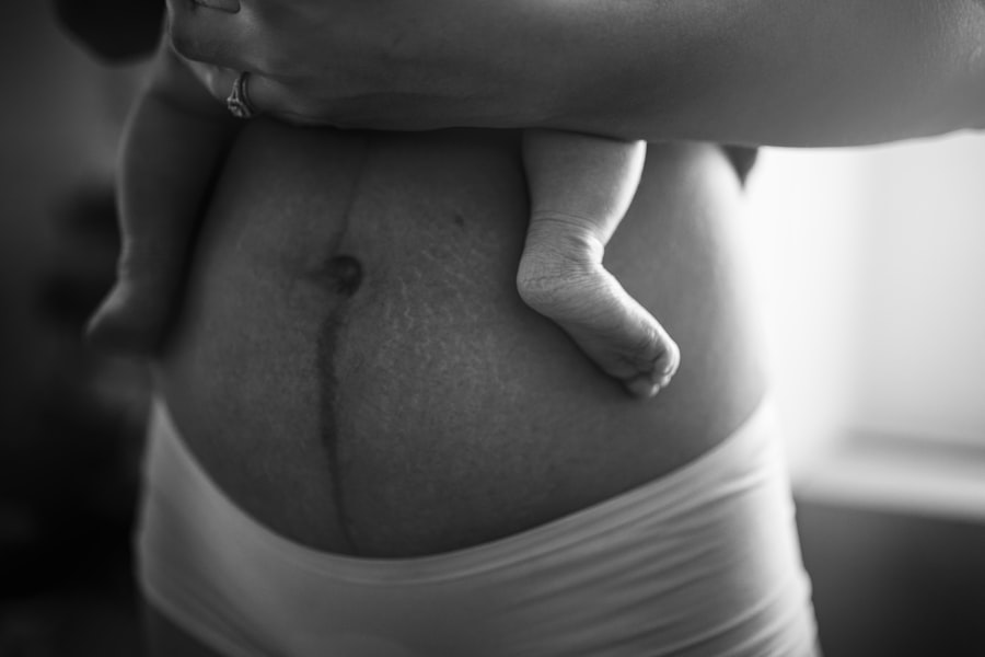 Pregnancy nutrition