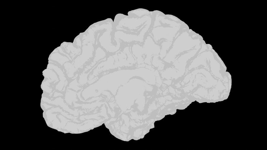 Photo Brain Changes